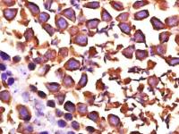 HSP90 alpha热休克蛋白90α单克隆抗体