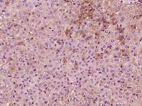 Phosphotyrosine磷酸化酪氨酸单克隆抗体