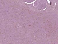 Thymosin beta 4胸腺素β4抗体