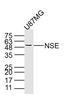 NSE神经元特异性烯醇化酶单克隆抗体