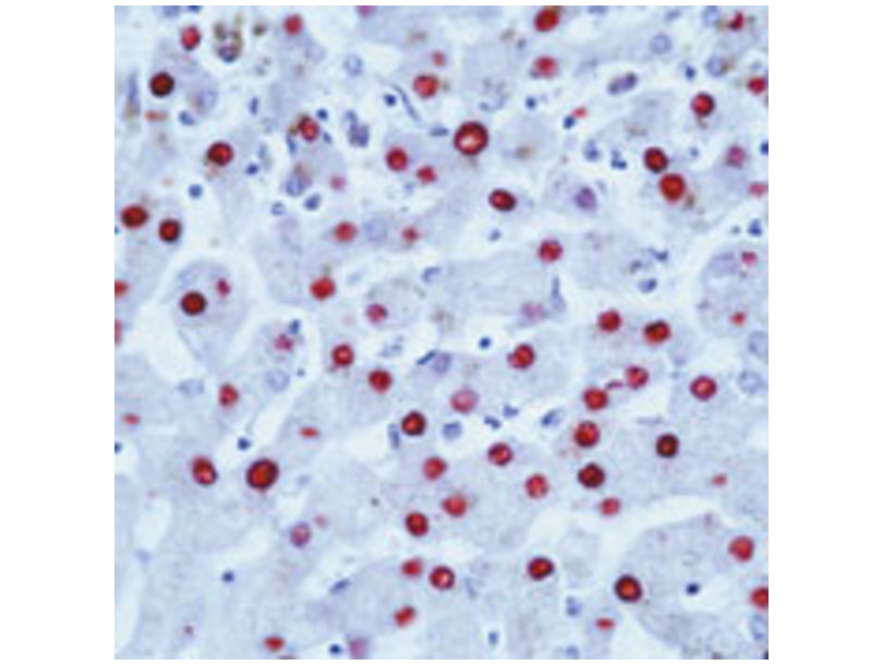 铬细胞瘤患者抑基因SDHB抗体