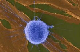 人星形胶质细胞抗体