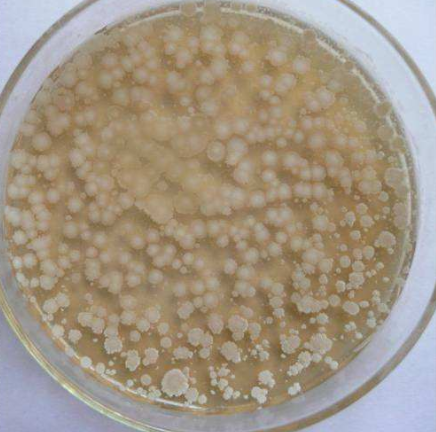 蜡状芽孢杆菌