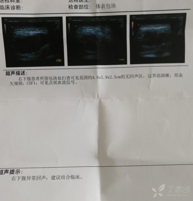 3294691738048473241-16w.jpg!w640