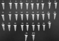 淀粉分支酶（SBE）检测试剂盒