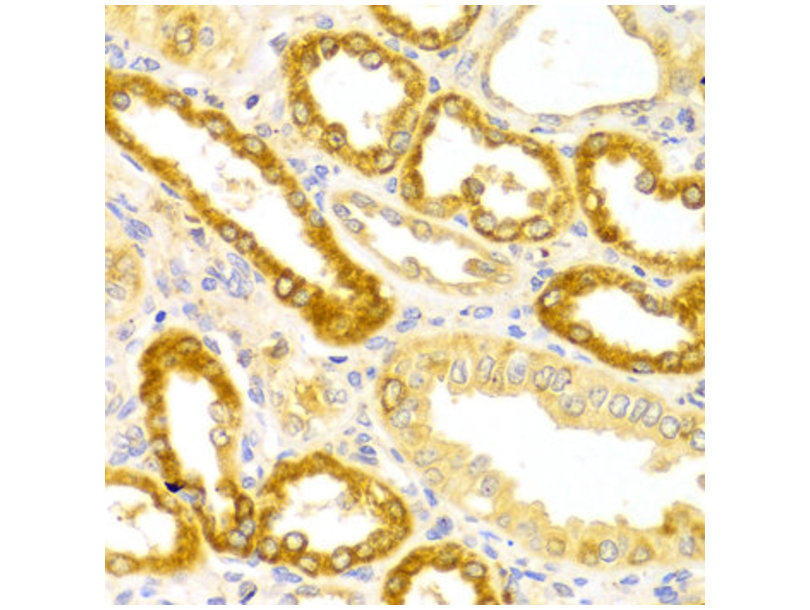 肌萎缩侧索硬化2染色体区域候选蛋白8抗体