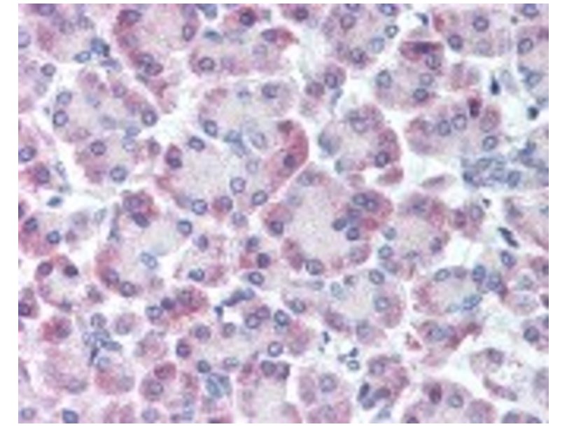 细胞增殖诱导蛋白5/肺癌相关蛋白10抗体