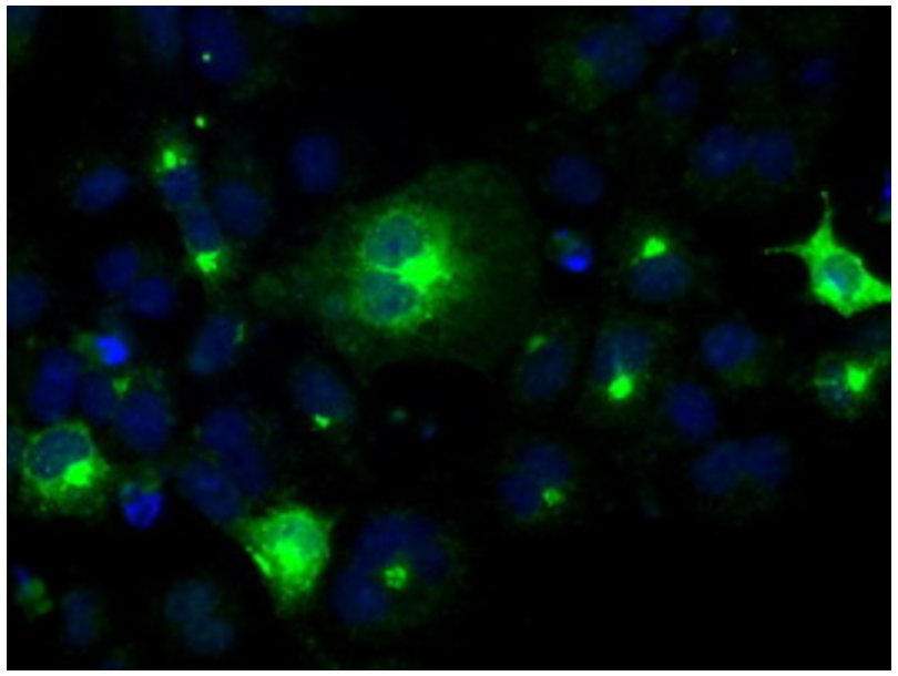 成熟T淋巴细胞增殖蛋白1抗体