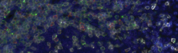 [网络研讨会]多光谱 QPS 成像联合 OPAL™ 多标和 RNAScope® 技术全面解析肿瘤微环境