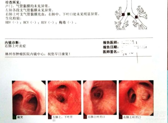 3294945800395952686-8w.jpg!w640