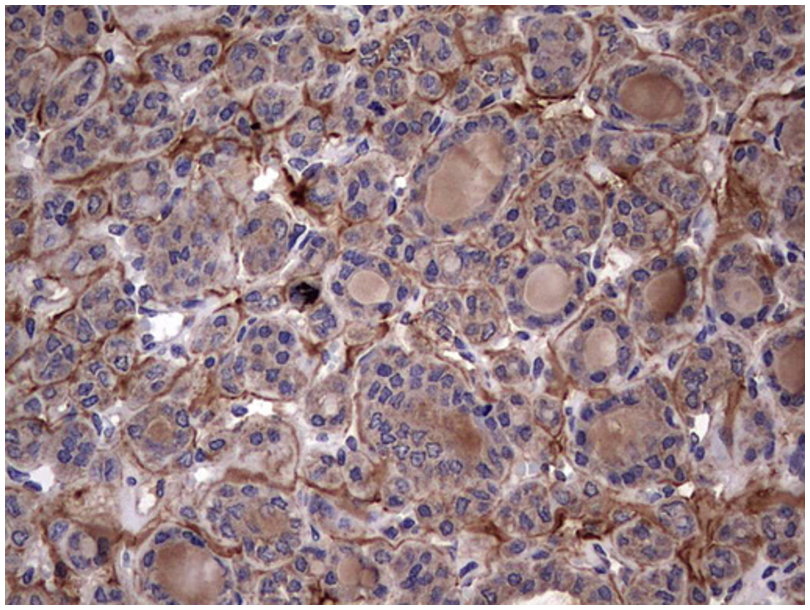 胰腺癌转移相关蛋白RLLM1抗体