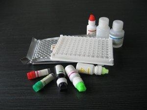 人苗条素受体(LR/Ob-R)检测试剂盒