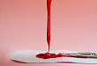 这例「功血」，来自极为罕见的阴道胚胎性横纹肌肉瘤