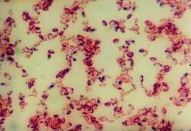 凝结芽孢杆菌