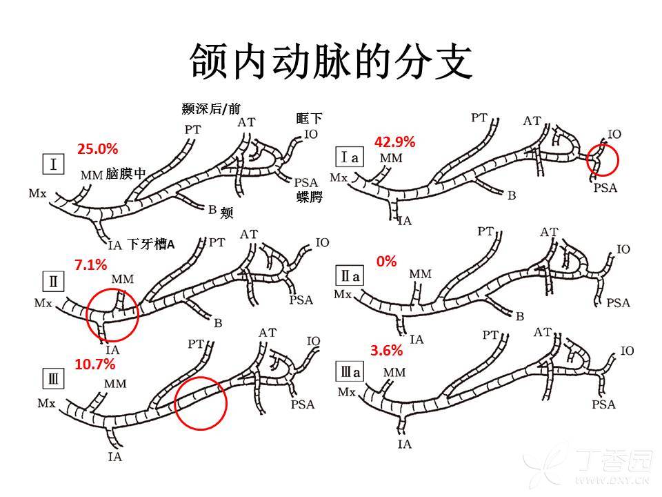 颌内动脉图片