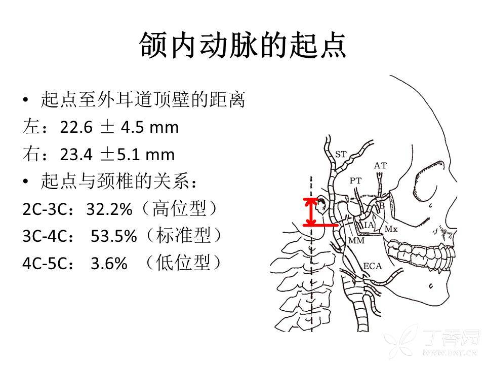 颌内动脉起于下颌骨髁突颈部深面