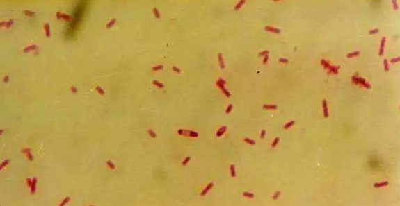 酪丁酸梭菌