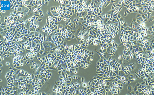 Bel-7402  人肝癌细胞  STR鉴定