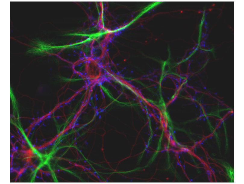 视神经细胞相关蛋白/早老素结合蛋白抗体