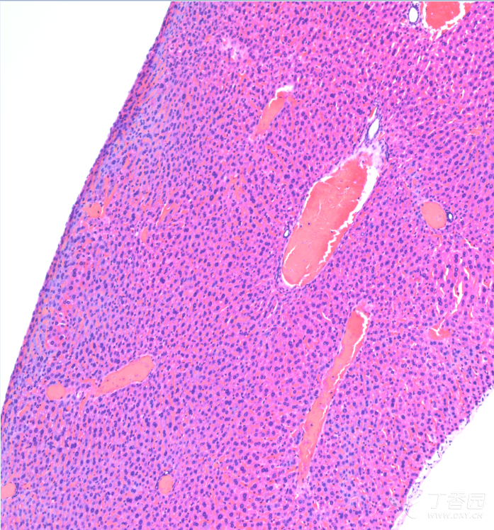 伊红染色不均匀原因