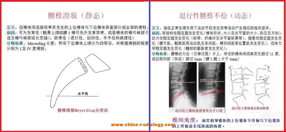 腰椎滑脫與不穩的鑑別