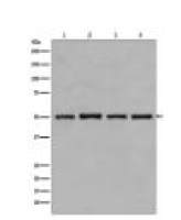 beta Tubulin Antibody