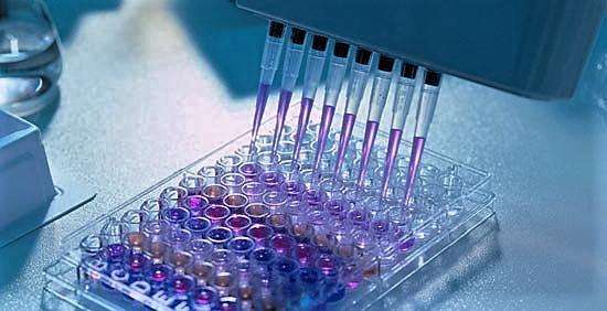 人可溶性CD30配体(sCD30L)ELISA试剂盒 