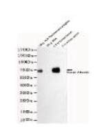 Human Serum Albumin Mouse mAb