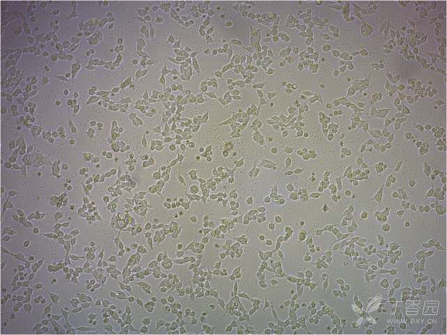 图为293t细胞 细胞状态差 请问这是神恶魔原因 这些小黑点是什么?