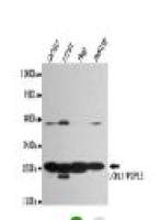 UCHL1/PGP9.5 Mouse mAb