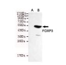 FOXP3 Mouse mAb