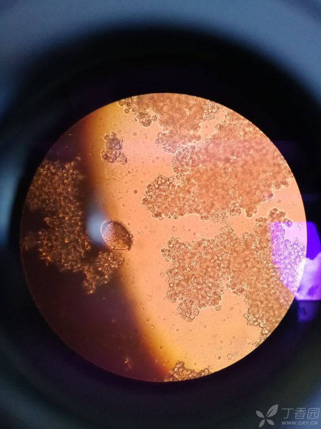 大便霉菌镜检图片图片