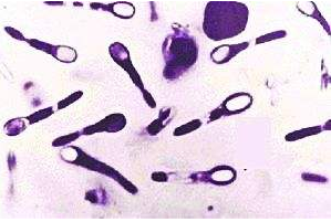 Bacilluskochii
