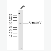 血管紧张素Ⅱ1A型受体抗体