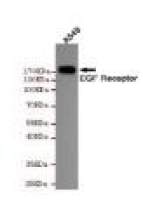 EGF Receptor Mouse mAb