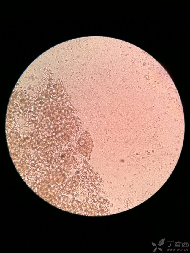 这个大便里的虫子是什么?