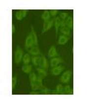 TUBB-FITC (FITC-Conjugate) Mouse mAb