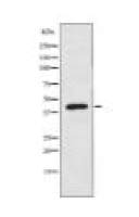 AKAP5 Antibody