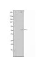 ALDH1B1 Antibody