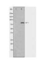 ABCB7 Antibody