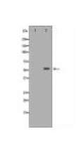 ALDH2 Antibody