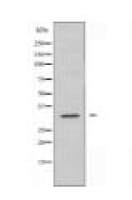 ACBD6 Antibody