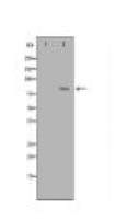 ADRBK2 Antibody