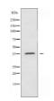 A4GNT Antibody