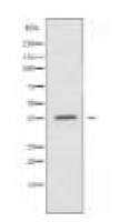 A4GNT Antibody