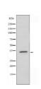 AKR1C2 Antibody