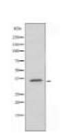 AKR1C2 Antibody