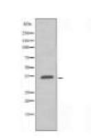 ADORA1 Antibody