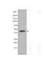 AGTR1 Antibody