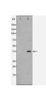 AKR1A1 Antibody